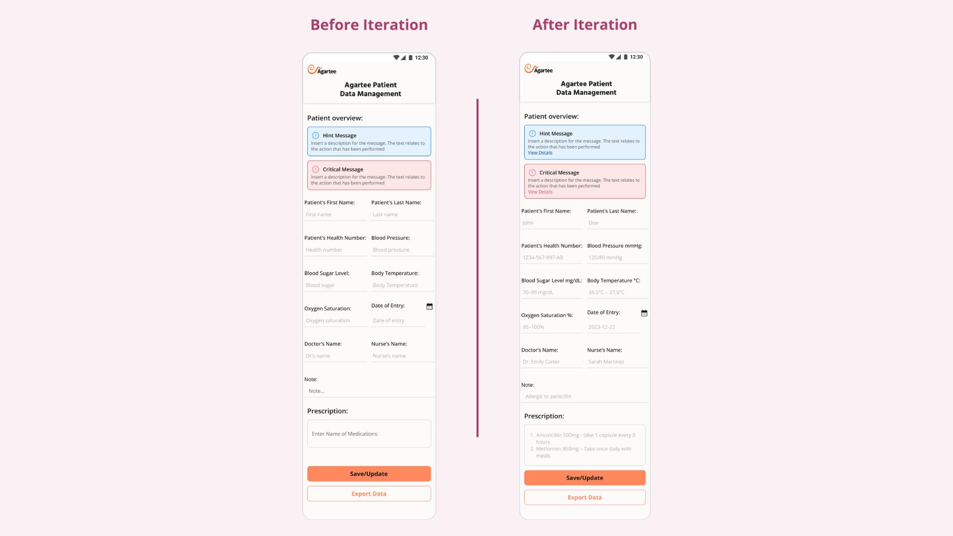 After and Before Iteration