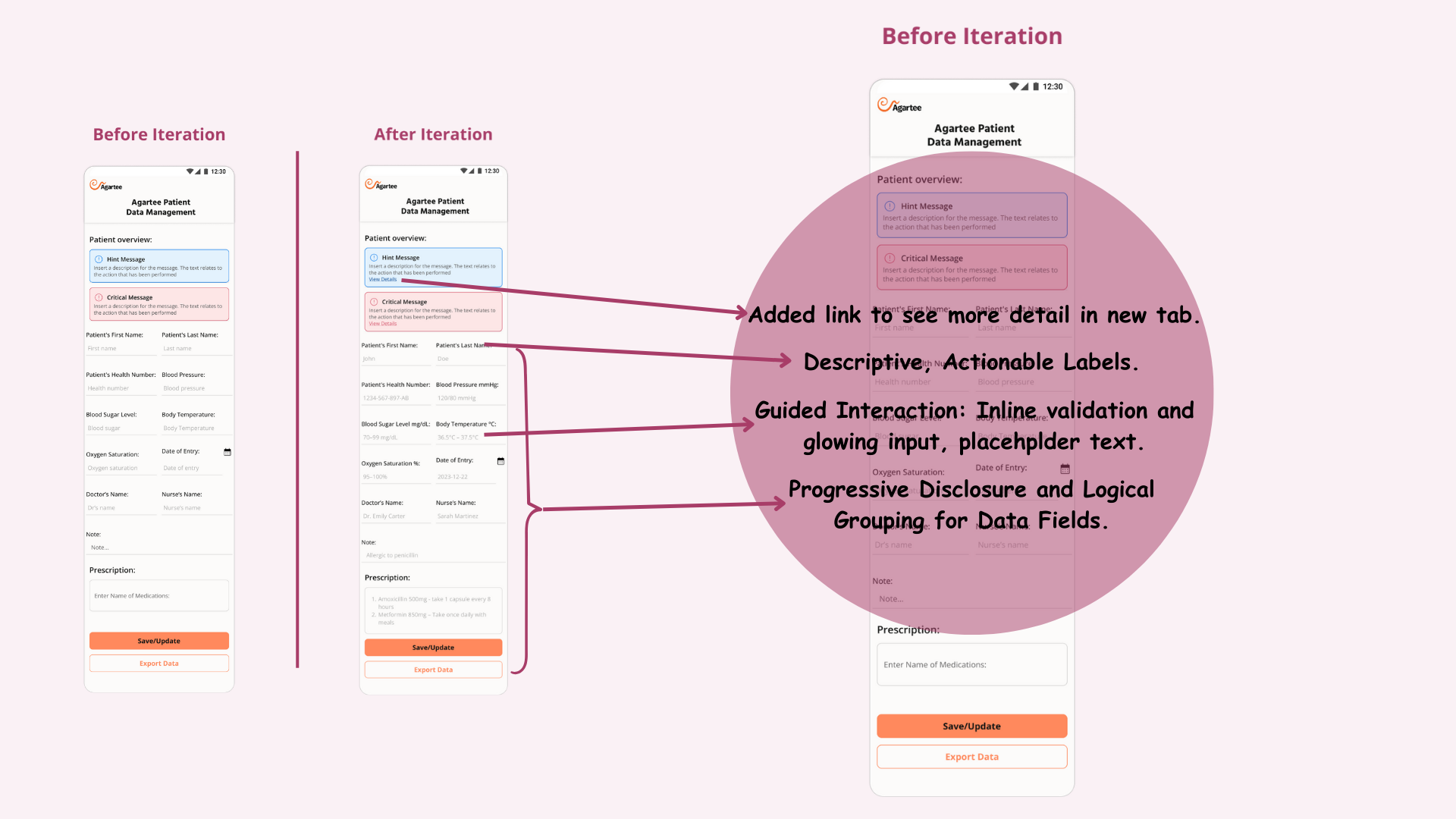 After and Before Iteration Explaination